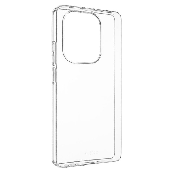 Fixed | Back protection | Xiaomi ...